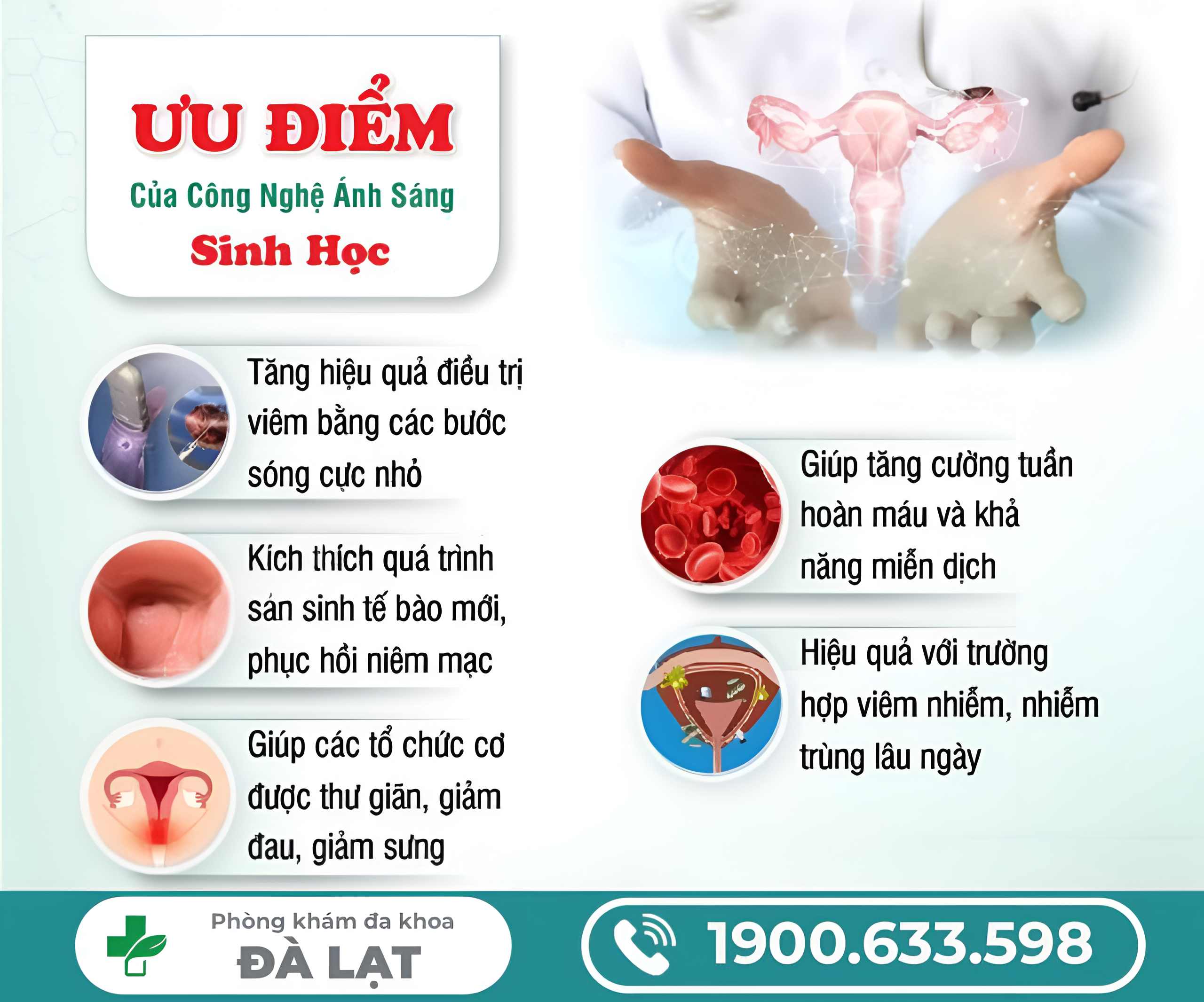 Hình ảnh minh họa